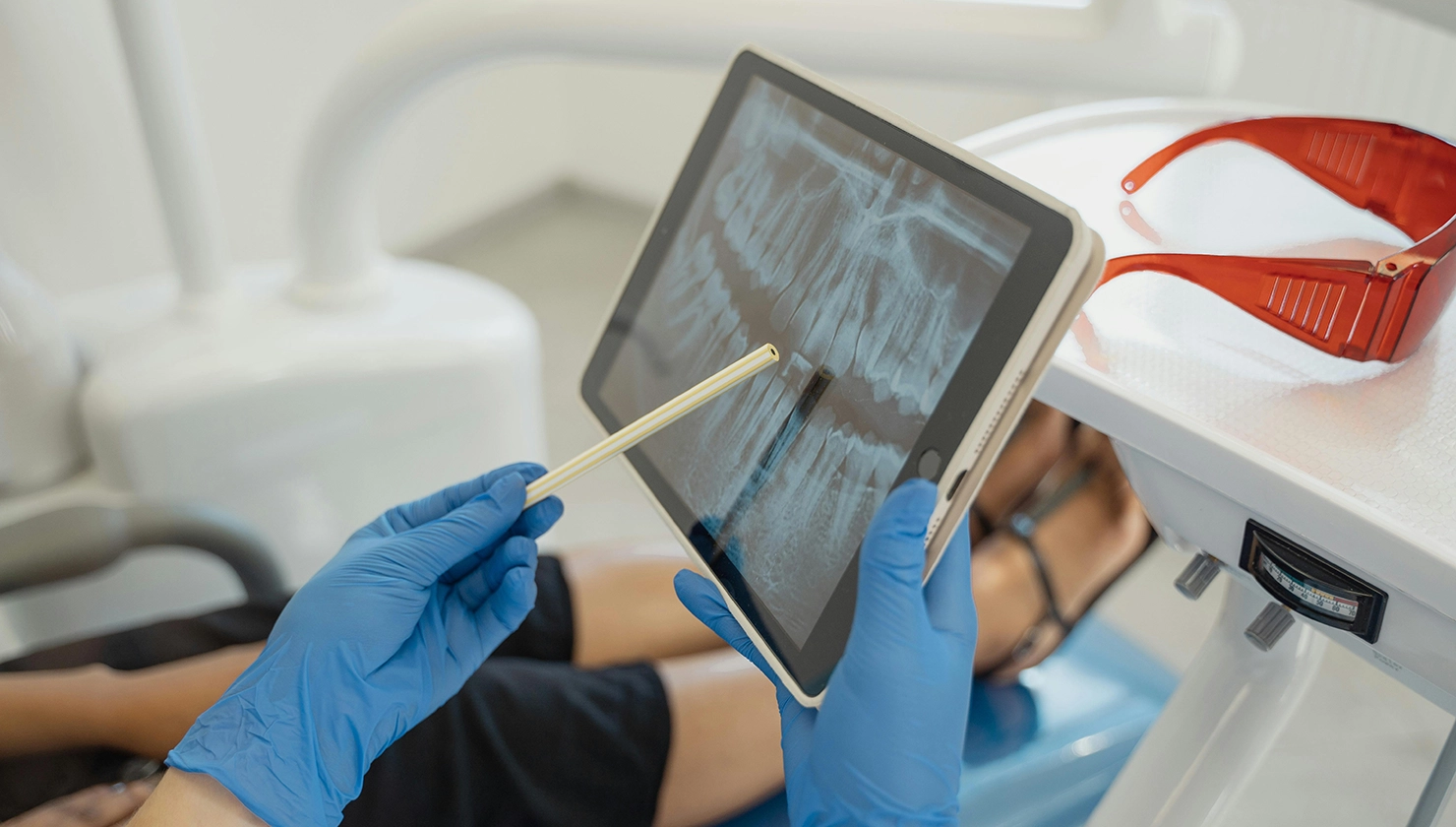 Dentista mostrant una radiografia digital per detectar problemes de periodontitis en un pacient.