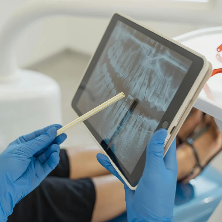 Dentista mostrant una radiografia digital per detectar problemes de periodontitis en un pacient.